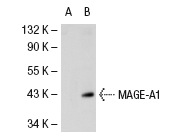  MAGE (6A111): sc-71537. Western blot analysis of MAGE expression in non-transfected: sc-117752 (A) and human MAGE transfected: sc-112260 (B) 293T whole cell lysates.