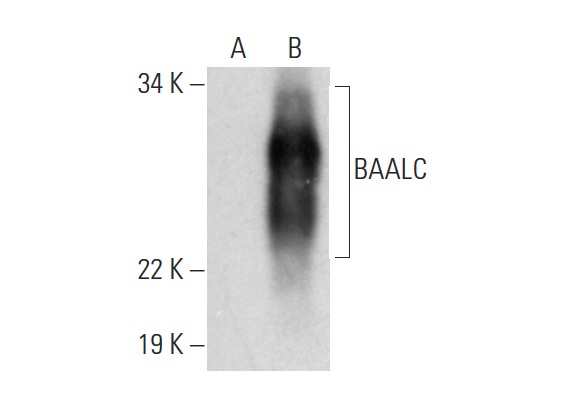  BAALC (H-54): sc-292585. Western blot analysis of BAALC expression in non-transfected: sc-117752 (A) and human BAALC transfected: sc-170308 (B) 293T whole cell lysates.