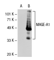  MAGE (6A111): sc-71537. Western blot analysis of MAGE-A1 expression in non-transfected: sc-110760 (A) and human MAGE-A1 transfected: sc-112260 (B) 293 whole cell lysates.