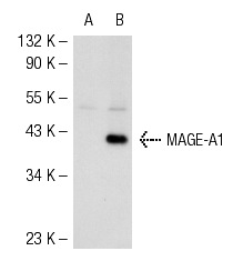  MAGE (6A111): sc-71537. Western blot analysis of MAGE-A1 expression in non-transfected: sc-117752 (A) and human MAGE-A1 transfected: sc-159131 (B) 293T whole cell lysates.