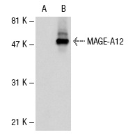  MAGE (6A111): sc-71537. Western blot analysis of MAGE-A12 expression in non-transfected: sc-110760 (A) and human MAGE-A12 transfected: sc-110824 (B) 293 whole cell lysates.