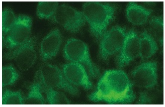  MAGE (6A111): sc-71537. Immunofluorescence staining of methanol-fixed HeLa cells showing cytoplasmic localization.