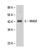  MAGE (5G152): sc-71536. Western blot analysis of MAGE expression in SK-MEL-28 whole cell lysate.