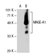  MAGE (5G152): sc-71536. Western blot analysis of MAGE-A1 expression in non-transfected: sc-110760 (A) and human MAGE-A1 transfected: sc-112260 (B) 293 whole cell lysates.