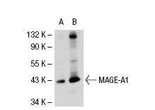  MAGE (5G152): sc-71536. Western blot analysis of MAGE expression in non-transfected: sc-117752 (A) and human MAGE transfected: sc-112260 (B) 293T whole cell lysates.