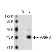  MAGE (5G152): sc-71536. Western blot analysis of MAGE-A1 expression in non-transfected: sc-117752 (A) and human MAGE-A1 transfected: sc-159131 (B) 293T whole cell lysates.