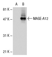  MAGE (5G152): sc-71536. Western blot analysis of MAGE-A12 expression in non-transfected: sc-110760 (A) and human MAGE-A12 transfected: sc-110824 (B) 293 whole cell lysates.