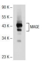  MAGE (5G152): sc-71536. Western blot analysis of MAGE expression in A-375 whole cell lysate.