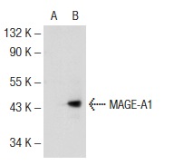  MAGE (5G152): sc-71536. Western blot analysis of MAGE-A1 expression in non-transfected: sc-117752 (A) and human MAGE-A1 transfected: sc-176623 (B) 293T whole cell lysates.