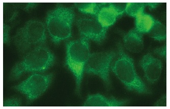  MAGE (5G152): sc-71536. Immunofluorescence staining of methanol-fixed HeLa cells showing cytoplasmic localization.