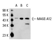  MAGE (A-16): sc-31321. Western blot analysis of MAGE-A12 expression in non-transfected 293: sc-110760 (A), human MAGE-A12 transfected 293: sc-110824 (B) and A-375 (C) whole cell lysates.