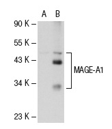  MAGE (A-16): sc-31321. Western blot analysis of MAGE-A1 expression in non-transfected: sc-110760 (A) and human MAGE-A1 transfected: sc-112260 (B) 293 whole cell lysates.