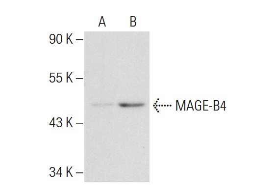  MAGE (A-16): sc-31321. Western blot analysis of MAGE-B4 expression in non-transfected: sc-117752 (A) and human MAGE-B4 transfected: sc-176213 (B) 293T whole cell lysates.