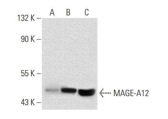  MAGE (A-16): sc-31321. Western blot analysis of MAGE-A12 expression in non-transfected 293T: sc-117752 (A), human MAGE-A12 transfected 293T: sc-175999 (B) and A-375 (C) whole cell lysates.