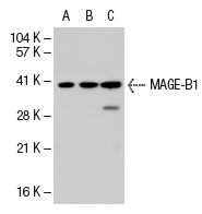  MAGE (A-16): sc-31321. Western blot analysis of MAGE-B1 expression in non-transfected 293T: sc-117752 (A), human MAGE-B1 transfected 293T: sc-113270 (B) and A-673 (C) whole cell lysates.