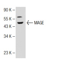  MAGE (A-16): sc-31321. Western blot analysis of MAGE expression in Jurkat whole cell lysate.