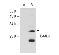  BAALC (T-16): sc-70023. Western blot analysis of BAALC expression in non-transfected: sc-117752 (A) and human BAALC transfected: sc-170308 (B) 293T whole cell lysates.