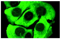  MAGE (FL-309): sc-10749. Immunofluorescence staining of methanol-fixed A-375 cells showing cytoplasmic localization.