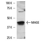  MAGE (FL-309): sc-10749. Western blot analysis of MAGE expression in A-375 whole cell lysate.