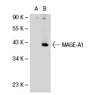  MAGE (FL-309): sc-10749. Western blot analysis of MAGE-A1 expression in non-transfected: sc-110760 (A) and human MAGE-A1 transfected: sc-112260 (B) 293 whole cell lysates.