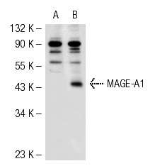  MAGE (FL-309): sc-10749. Western blot analysis of MAGE-A1 expression in non-transfected: sc-117752 (A) and human MAGE-A1 transfected: sc-159131 (B) 293T whole cell lysates.