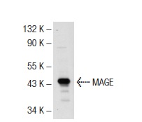  MAGE (FL-309): sc-10749. Western blot analysis of MAGE expression in A-375 whole cell lysate.