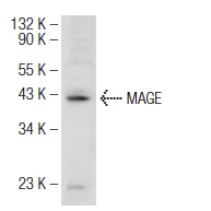  MAGE (FL-309): sc-10749. Western blot analysis of MAGE expression in Hs 294T whole cell lysate.