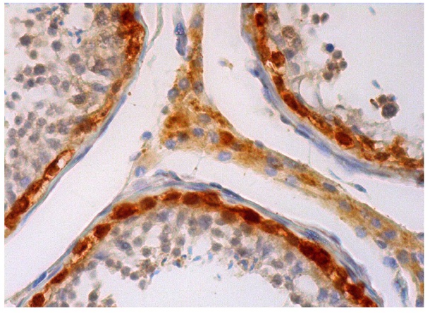  MAGE (FL-309): sc-10749. Immunoperoxidase staining of formalin fixed, paraffin-embedded human testis tissue showing cytoplasmic and nuclear staining of basal cells in seminiferous ducts and weak cytoplasmic staining of Leydig cells.