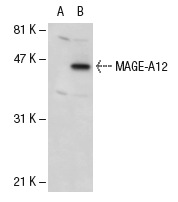  MAGE (I-17): sc-31320. Western blot analysis of MAGE expression in non-transfected: sc-110760 (A) and human MAGE-A1 transfected: sc-112260 (B) 293 whole cell lysates.