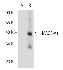  MAGE (I-17): sc-31320. Western blot analysis of MAGE-A1 expression in non-transfected: sc-110760 (A) and human MAGE-A1 transfected: sc-112260 (B) 293 whole cell lysates.