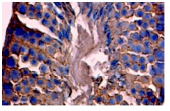  MAGE (Y-18): sc-12805. Immunoperoxidase staining of formalin fixed, paraffin-embedded mouse testis tissue showing cytoplasmic and membrane localization.