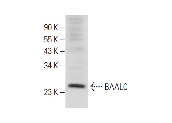  BAALC (A-14): sc-70020. Western blot analysis of BAALC expression in HEK293 whole cell lysate.