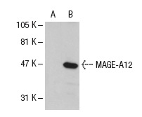  MAGE (Y-18): sc-12805. Western blot analysis of MAGE-A12 expression in non-transfected: sc-110760 (A) and human MAGE-A12 transfected: sc-110824 (B) 293 whole cell lysates.