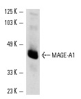  MAGE-A1 (MA454): sc-20033. Western blot analysis of MAGE-A1 expression in A-375 whole cell lysate.