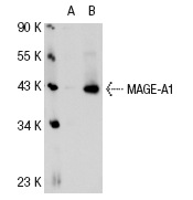  MAGE-A1 (MA454): sc-20033. Western blot analysis of MAGE-A1 expression in non-transfected: sc-110760 (A) and human MAGE-A1 transfected: sc-112260 (B) 293 whole cell lysates.