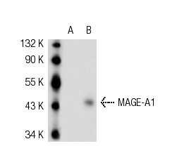  MAGE-A1 (MA454): sc-20033. Western blot analysis of MAGE-A1 expression in non-transfected: sc-117752 (A) and human MAGE-A1 transfected: sc-159131 (B) 293T whole cell lysates.