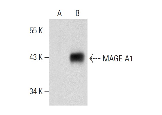  MAGE-A1 (MA454): sc-20033. Western blot analysis of MAGE-A1 expression in non-transfected: sc-117752 (A) and human MAGE-A1 transfected: sc-159131 (B) 293T whole cell lysates.