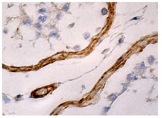  MAGE-A1 (MA454) : sc-20033. Immunoperoxidase staining of formalin fixed, paraffin-embedded human testis tissue showing cytoplasmic staining of pertibular myoid cells.