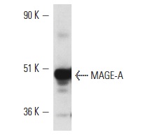  MAGE-A (6C1): sc-20034. Western blot analysis of MAGE-A expression in SK-MEL-28 whole cell lysate.