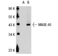  MAGE-A (6C1): sc-20034. Western blot analysis of MAGE-A1 expression in non-transfected: sc-110760 (A) and human MAGE-A1 transfected: sc-112260 (B) 293 whole cell lysates.