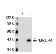  MAGE-A (6C1): sc-20034. Western blot analysis of MAGE-A1 expression in non-transfected: sc-117752 (A) and human MAGE-A1 transfected: sc-159131 (B) 293T whole cell lysates.