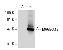  MAGE-A (6C1): sc-20034. Western blot analysis of MAGE-A12 expression in non-transfected: sc-110760 (A) and human MAGE-A12 transfected: sc-110824 (B) 293 whole cell lysates.