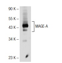  MAGE-A (6C1): sc-20034. Western blot analysis of MAGE-A expression in A-375 whole cell lysate.