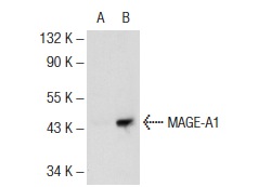  MAGE-A (6C1): sc-20034. Western blot analysis of MAGE-A1 expression in non-transfected: sc-117752 (A) and human MAGE-A1 transfected: sc-176623 (B) 293T whole cell lysates.