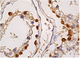  MAGE-A (6C1): sc-20034. Immunoperoxidase staining of formalin fixed, paraffin-embedded human testis tissue showing cytoplasmic and nuclear staining of subset of cells in seminiferous ducts.