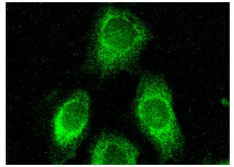  MAGE-A (6C1): sc-20034. Immunofluorescence staining of methanol-fixed HeLa cells showing cytoplasmic localization.