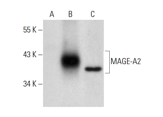  MAGE-A (6C1): sc-20034. Western blot analysis of MAGE-A2 expression in non-transfected: sc-117752 (A) and human MAGE-A2 transfected: sc-369093 (B) 293T whole cell lysates and human liver tissue extract (C).