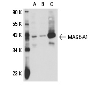  MAGE-A1 (3F256): sc-71539. Western blot analysis of MAGE-A1 expression in U-87 MG (A), SK-MEL-28 (B) and Hs 294T (C) whole cell lysates.