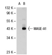  MAGE-A1 (3F256): sc-71539. Western blot analysis of MAGE-A1 expression in non-transfected: sc-110760 (A) and human MAGE-A1 transfected: sc-112260 (B) 293 whole cell lysates.