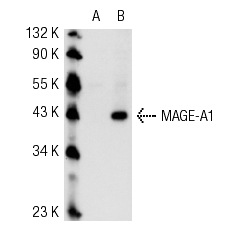  MAGE-A1 (3F256): sc-71539. Western blot analysis of MAGE-A1 expression in non-transfected: sc-117752 (A) and human MAGE-A1 transfected: sc-159131 (B) 293T whole cell lysates.